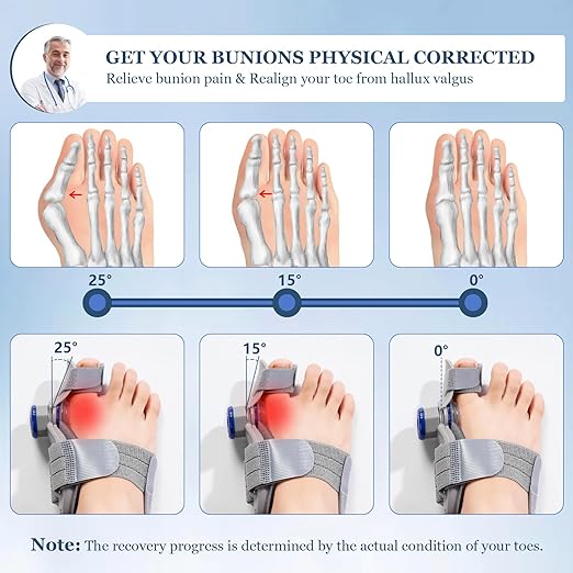 FeetifFix Bunion Corrector – Adjustable Toe Alignment Support Brace (1 PCS)